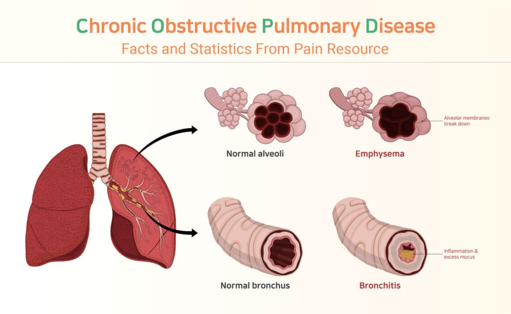 What Is COPD