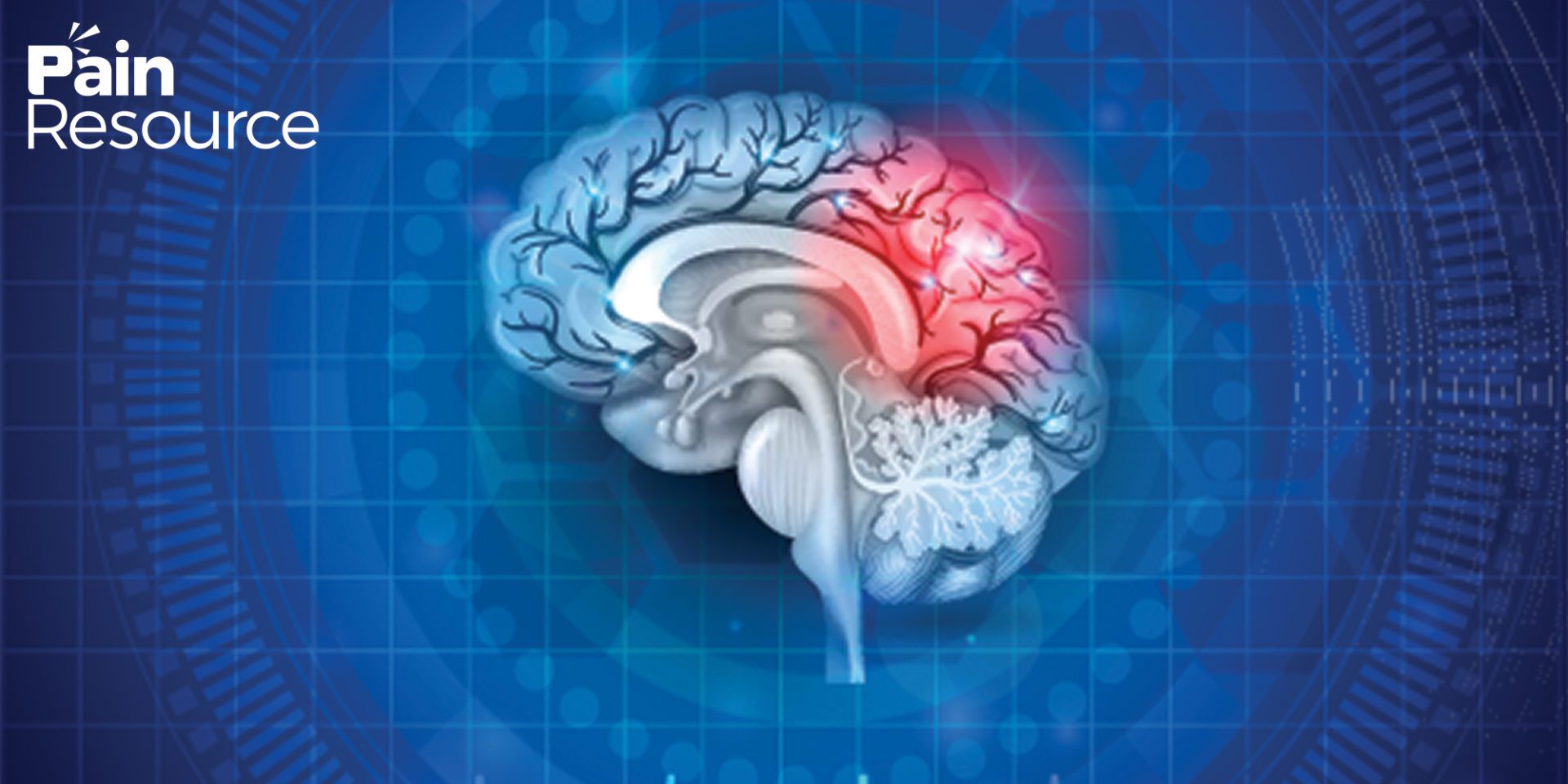 Concussions