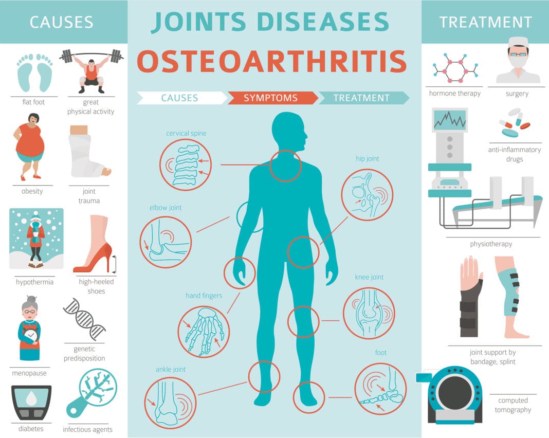 What is Osteoarthritis? Causes, Symptoms & Risk Factors of Osteoarthritis