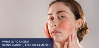 What Is Rosacea? Signs, Causes, and Treatments
