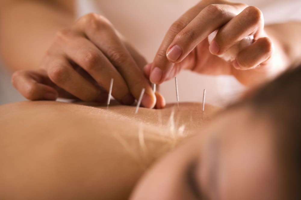 acupuncture for chronic pain